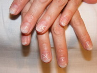 Csillám zselés, Francia